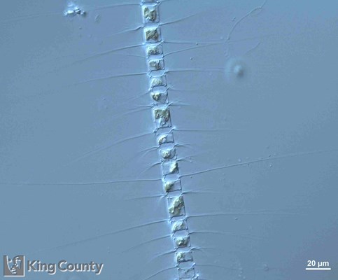 Photo of Chaetoceros crucifer